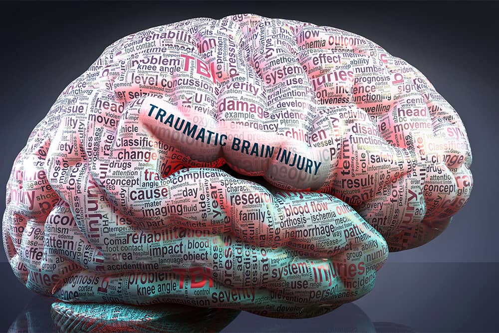 traumatic brain injury compensation